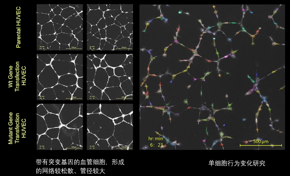 6、血管分析.png